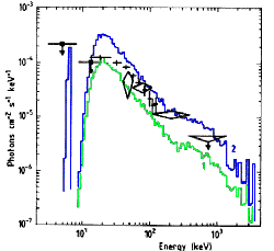 SN1987A